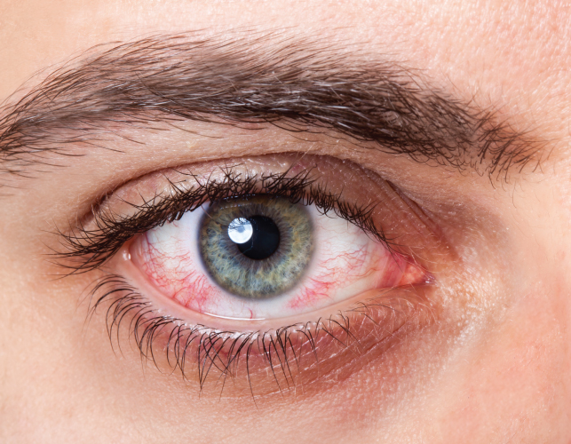 โรคที่เกี่ยวกับสายตาเมื่ออายุมากขึ้น